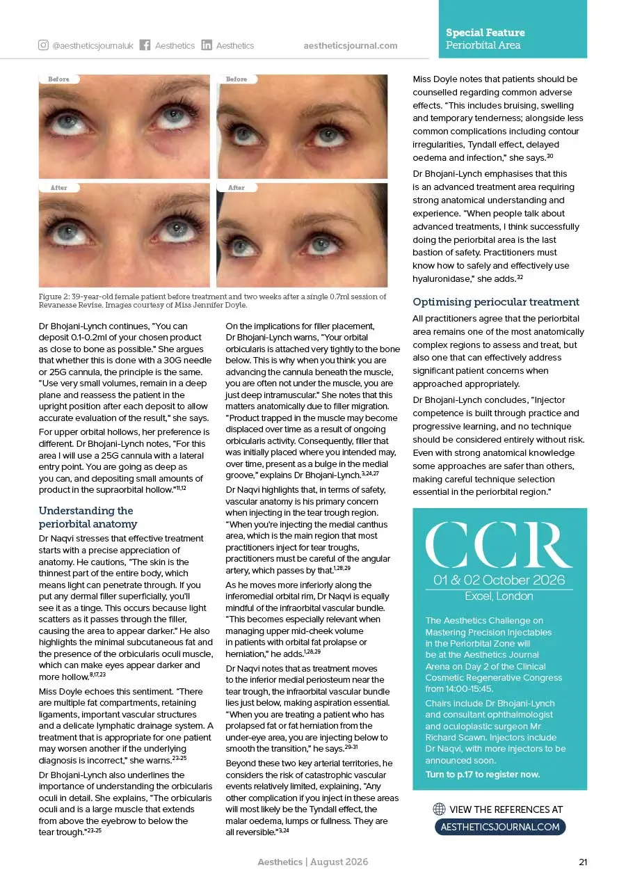 Aesthetics-Journal-Mastering-Precision-Injectables-in-the-Periorbital-Zone-August-2026-3